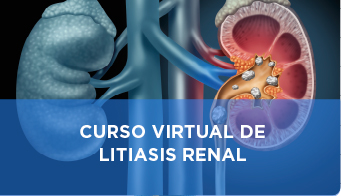 Curso virtual de litiasis renal